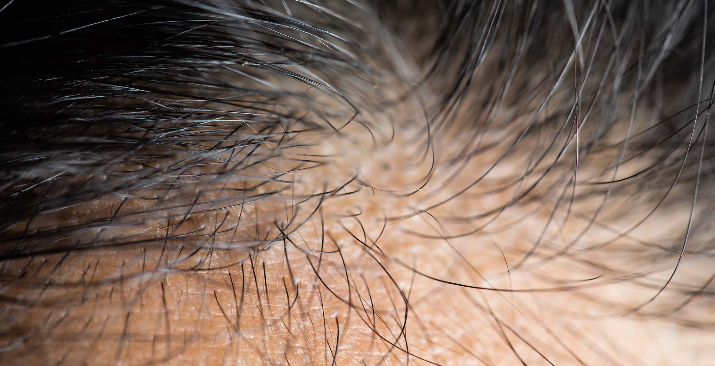 scalp care for healthy hair