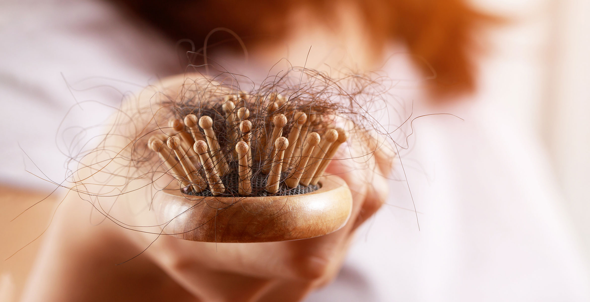 seasonal hair loss explained