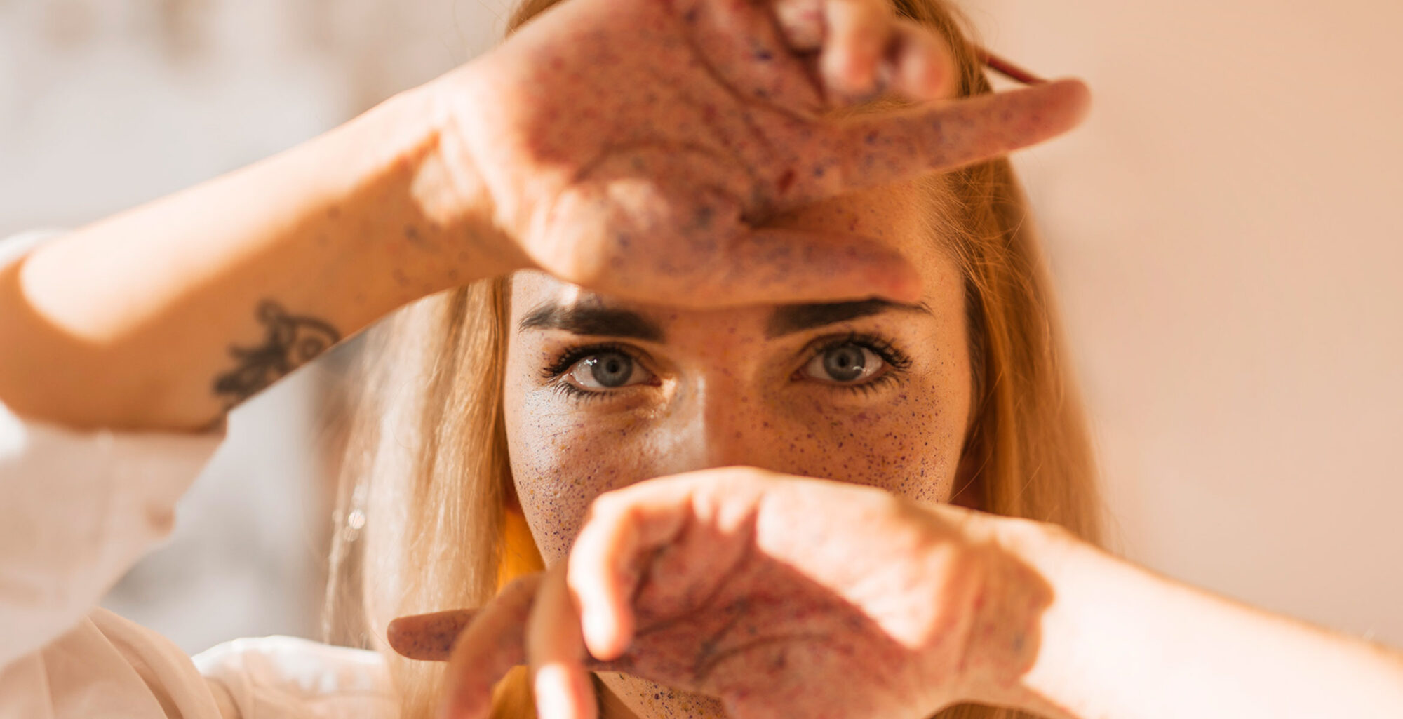 Skin discolouration Twelve Beauty