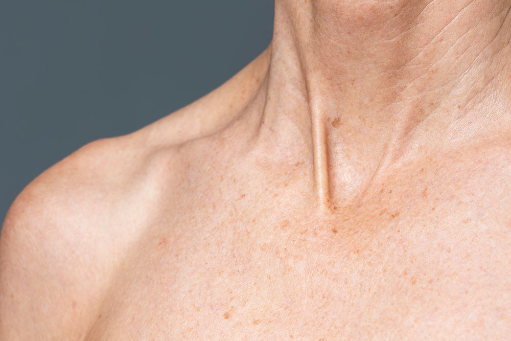 neck skincare in menopause