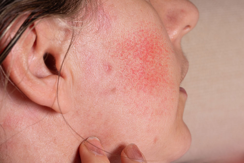 ice dunking effects on skin