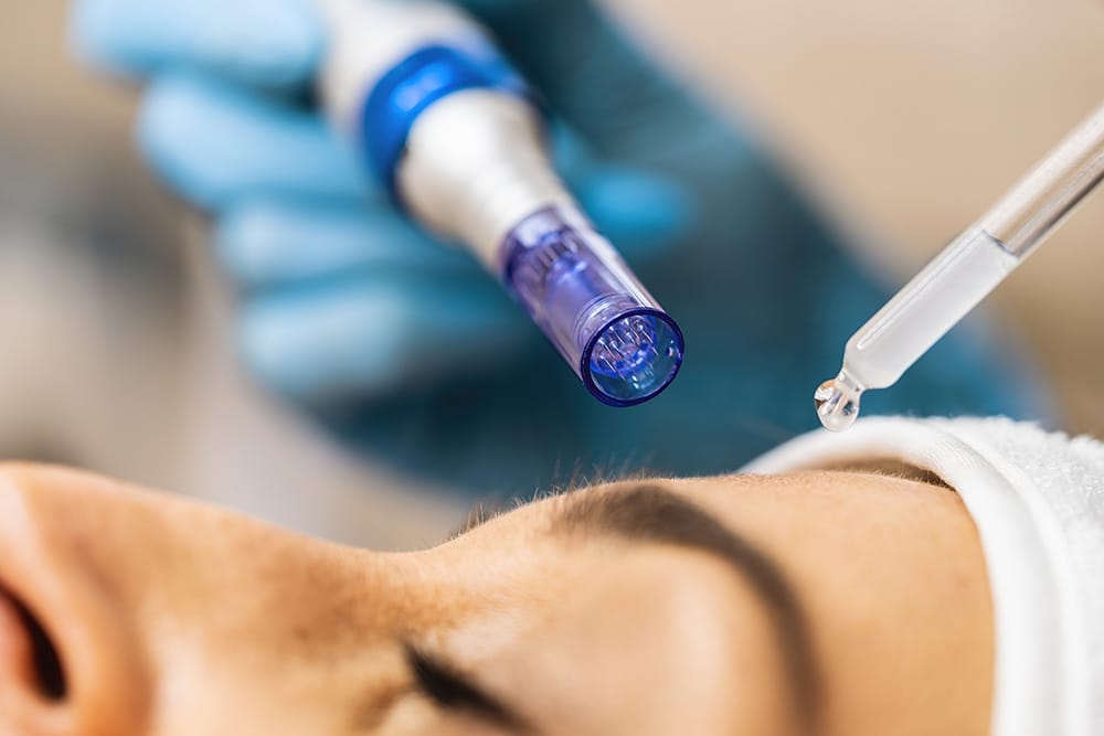 microneedling serum
