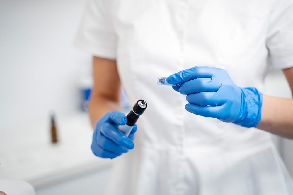 professional microneedling vs at home treatments