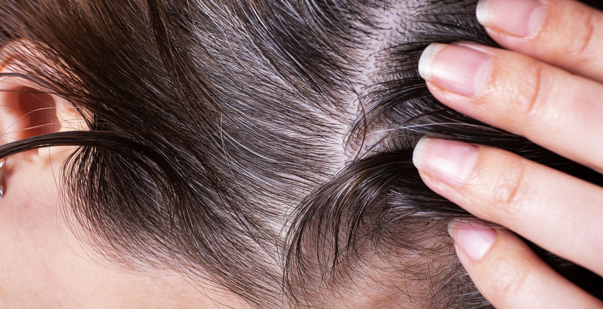 scalp microbiome twelve beauty