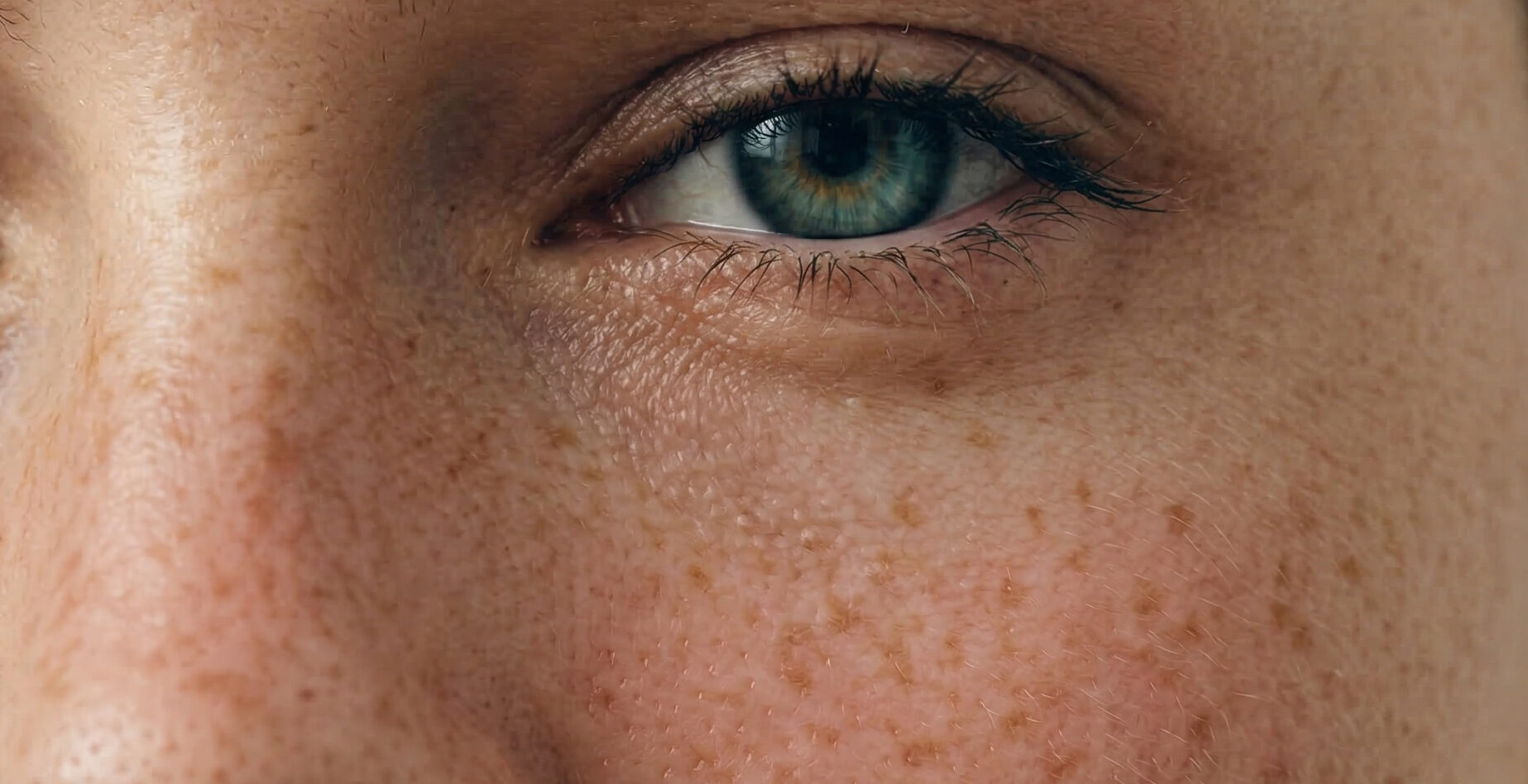 skin allergy with dryness and flaking