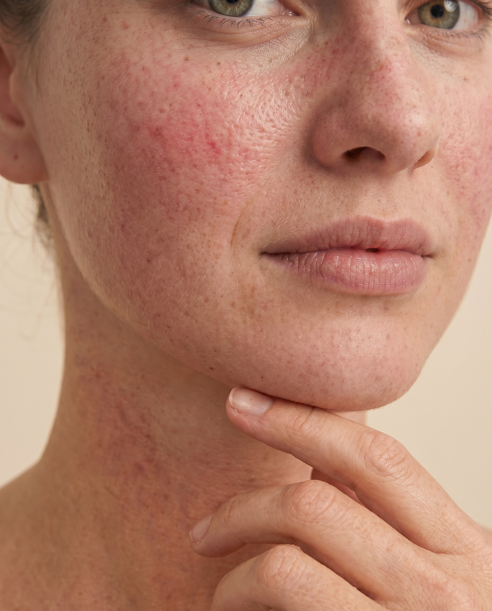 skin with redness and a sensitive skin barrier