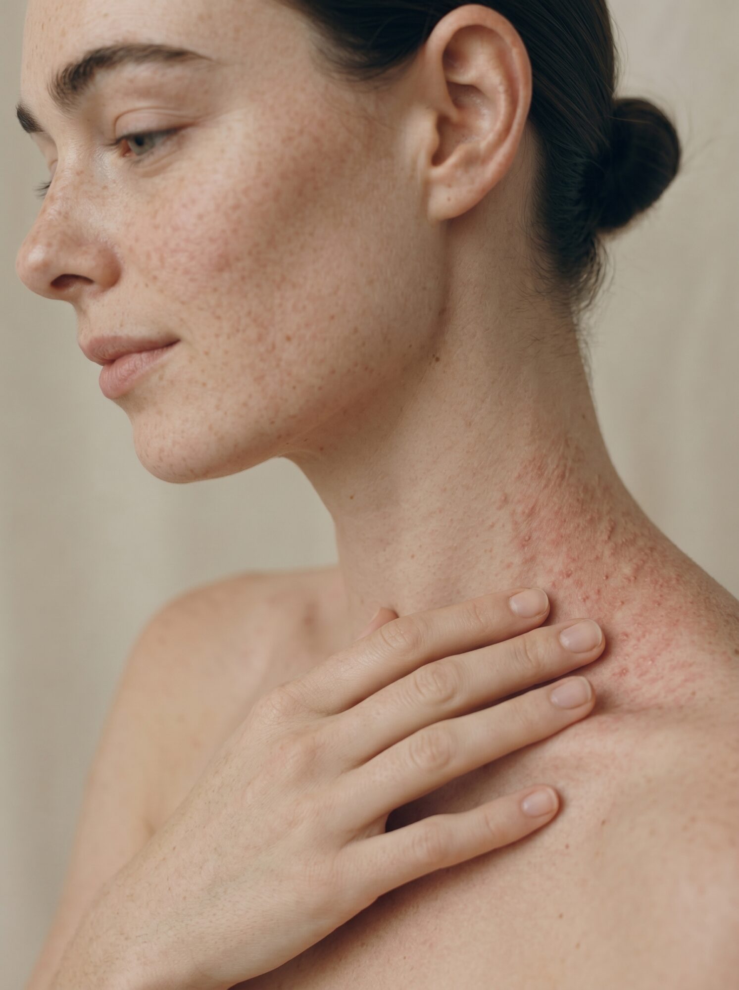 stressed skin with redness and visible discomfort