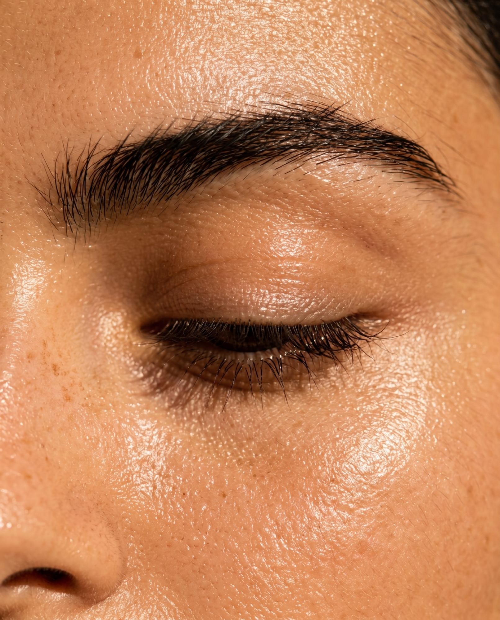 Close-up skin texture showing dehydration, sensitivity and dull-looking skin before an event.